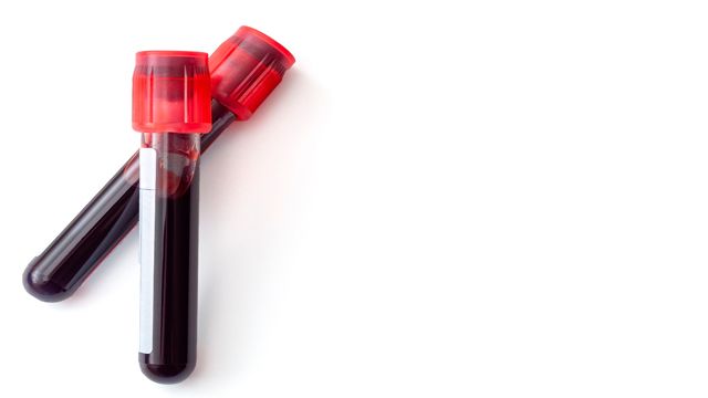 Two test tubes containing blood samples representing a new blood test for cardiac arrest patients.  