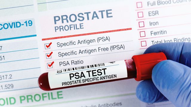 Gloved hand holding a barcoded tube of blood labeled for PSA testing with a prostate profile testing form in the background. 