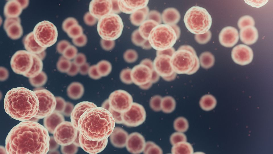 3D illustration of cancer cells under a microscope, showing clusters of abnormal, rapidly dividing cells with textured surfaces against a dark background.