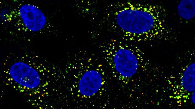 Dengue-infected cells taken under a microscope. 