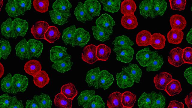Fluorescent-stained cells under a microscope showing structural details used in flow cytometry analysis. 